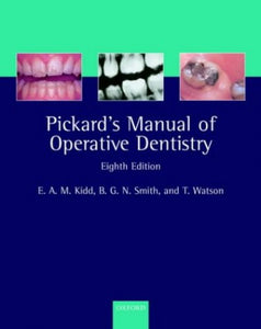 Pickard's Manual of Operative Dentistry 