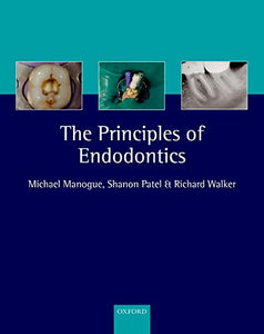 The Principles of Endodontics 