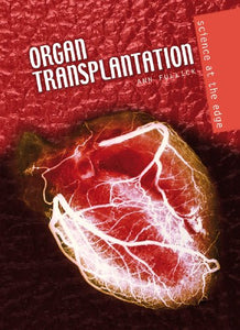 Organ Transplantation 