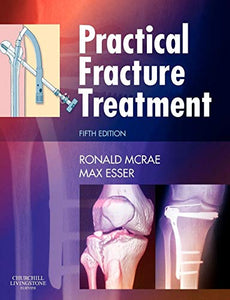 Practical Fracture Treatment 