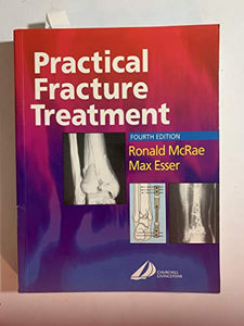 Practical Fracture Treatment 