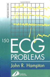 150 ECG Problems 