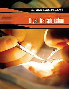 Organ Transplantation 