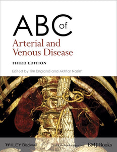 ABC of Arterial and Venous Disease 