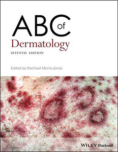 ABC of Dermatology 