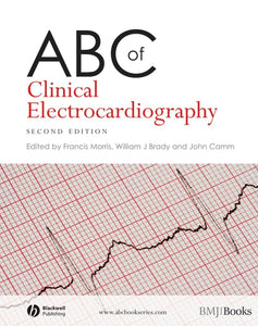 ABC of Clinical Electrocardiography 