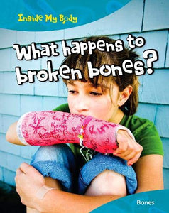 What Happens to Broken Bones? 