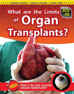 What Are the Limits of Organ Transplantation? 