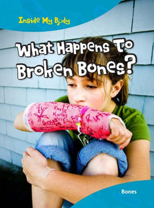 What Happens to Broken Bones?: Bones (Inside My Body) 