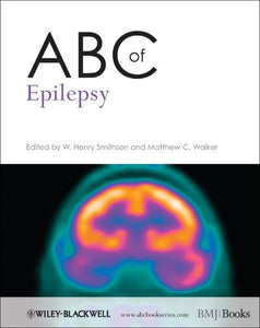 ABC of Epilepsy 