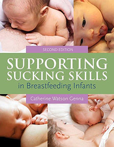 Supporting Sucking Skills In Breastfeeding Infants 