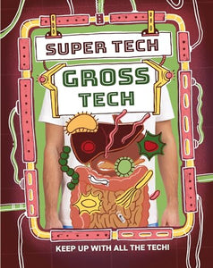 Super Tech: Gross Tech 