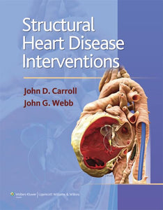 Structural Heart Disease Interventions 