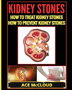 Kidney Stones 