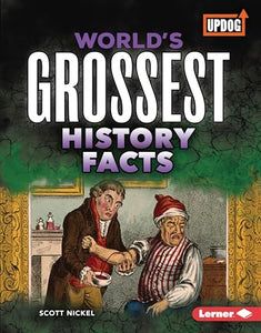 World's Grossest History Facts 