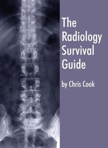 The Radiology Survival Guide 