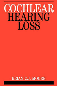 Cochlear Hearing Loss 