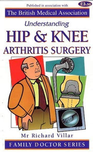 Understanding Hip and Knee Arthritis Surgery 