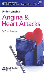 Understanding Angina & Heart Attacks 