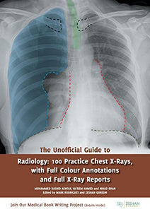 The Unofficial Guide to Radiology: 100 Practice Chest X Rays with Full Colour Annotations and Full X Ray Reports 