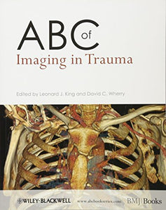 ABC of Imaging in Trauma 